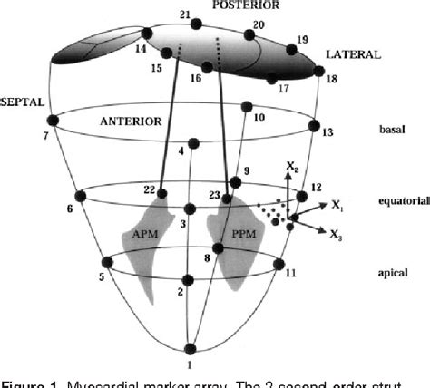 Figure From Importance Of Mitral Valve Second Order Chordae For Left