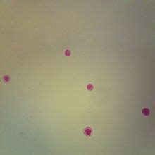 Peridinium, w.m. Microscope Slide | Carolina Biological Supply