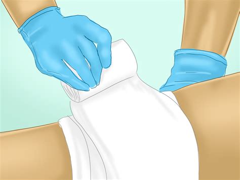 How to Treat a Wound: 10 Steps (with Pictures) - wikiHow