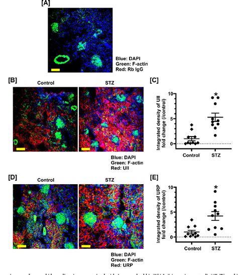 Figure 2 From Urotensin II System In Chronic Kidney Disease Semantic