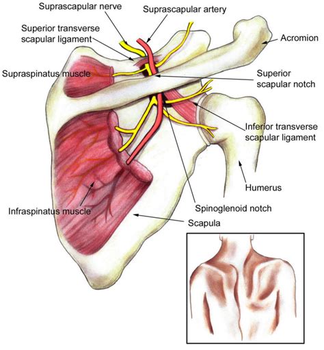 Suprascapular Neuropathy Causes Symptoms Diagnosis Treatment Prognosis