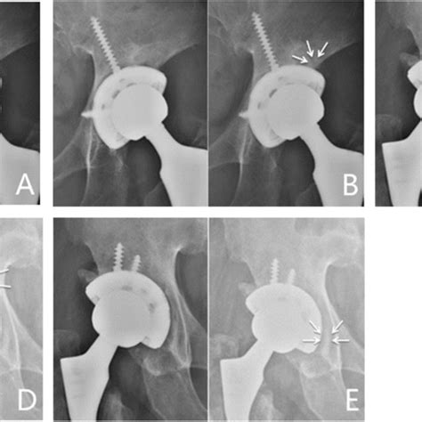 Representative Cases With Radiographic Signs Of Osseointegration As Download Scientific Diagram