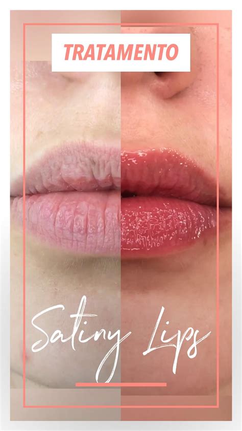 Macro Beauty Spa Hidra Lip Dermapen Orlando Fl Artofit