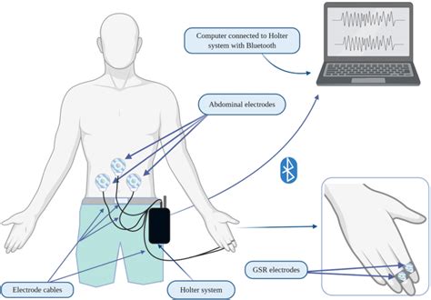 A Schematic Figure Of The Holter System The Figure Represents The