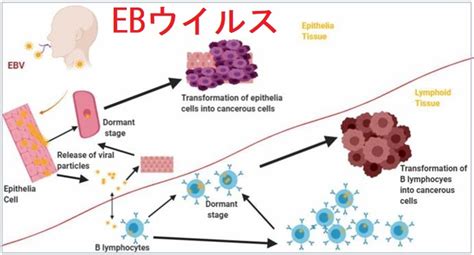 Eb ウイルス と は 👣 Ebウイルス感染症とは症状・感染経路・治療法 感染症 All About