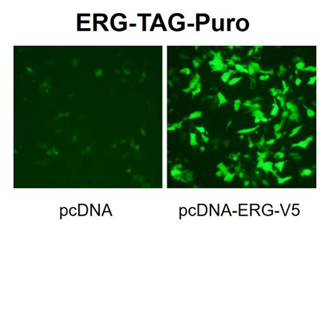 Erg Reporter Lentivirus Lipexogen Biotech