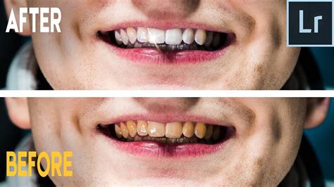 How To Whiten Teeth In Seconds In Adobe Lightroom Quick Easy