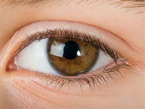 Periorbital Inflammations In Children Differential Diagnosis Of