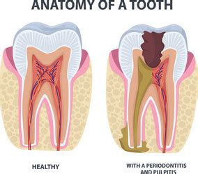 Tooth Anatomy Dental Infographics Medical Banner Vector Image