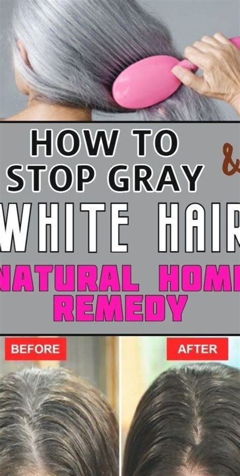 How To Stop Gray And White Hair Natural Home Remedies Modernife Remedy For White Hair Grey