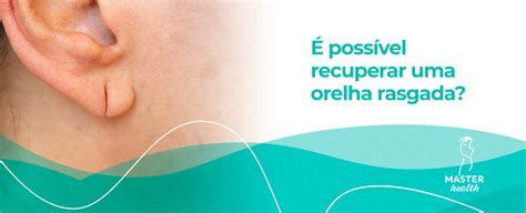 Orelha Rasgada Poss Vel Recuperar Blog Master Health