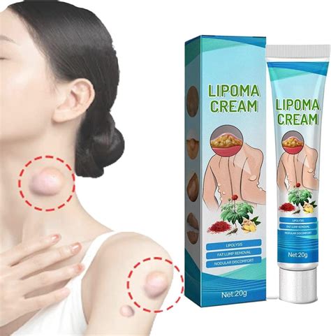 Lumpfree Lipoma Removal Cream Lipoma Removal Cream Lipoma Removal Cream