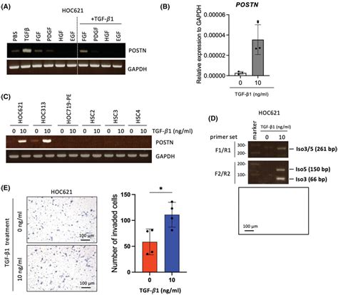 The Upregulation Of Postn Expression And Detection Of Isoforms In