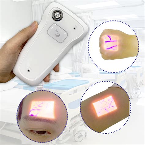 Buy Infrared Vein Finder Viewer Handheld Vein Locator Vein