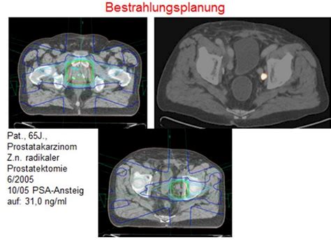 Das Pet Ct Mta R De