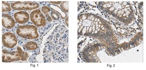 Anti Prohibitin Antibody From Rabbit Purified By Affinity