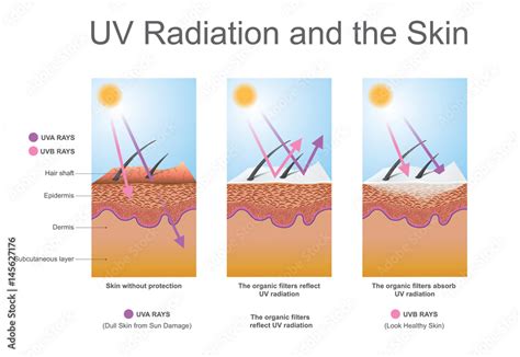 Uv Radiation And The Skin Effects The Elastin In The Skin And Leads To