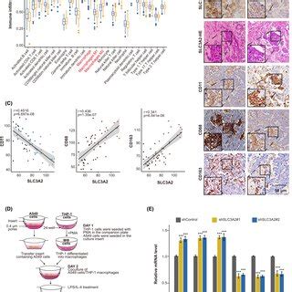 SLC3A2 Is Significantly Highly Expressed And Associated With Poor