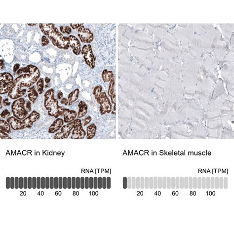 mouse monoclonal anti amacr antibody buy  research highly