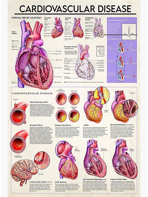 Cardiologist Cardiovascular Disease Poster For Sale By Campenklein