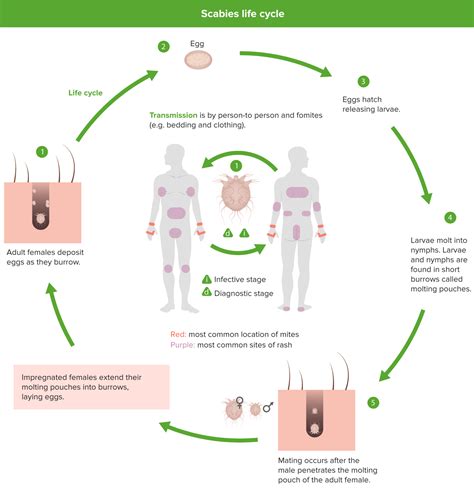 Scabies Concise Medical Knowledge