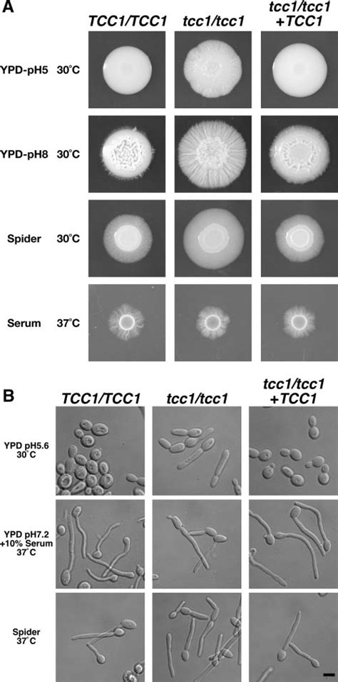 Morphology Of C Albicans Strains Grown On Solid Agar Medium A And In Download Scientific