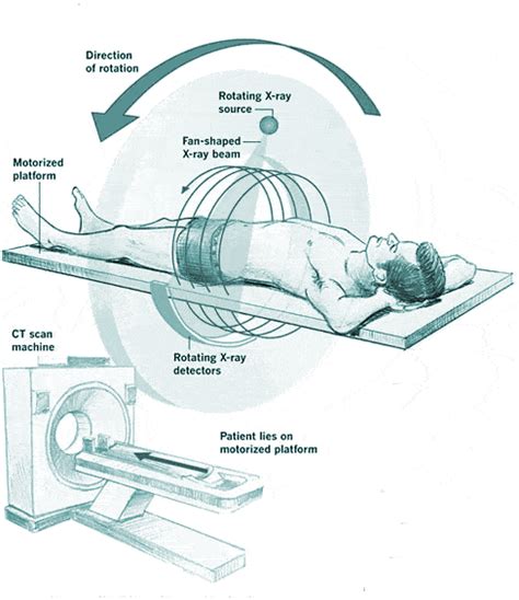 Ct Scan Parts And Functions