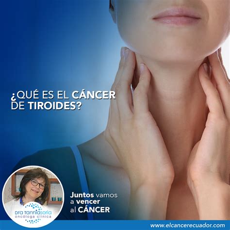 Qué es el cáncer de tiroides Dra Tannia Soria Oncóloga Clínica