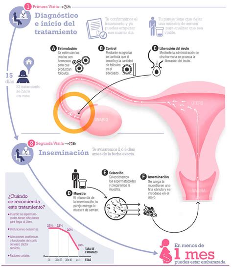 Qu Es La Inseminaci N Artificial Cl Nica Eugin