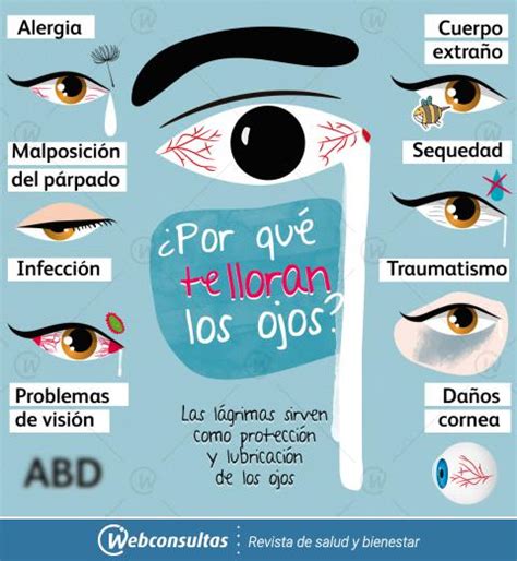 Qué Significa Llorar Por El Ojo Derecho Normalweb Es