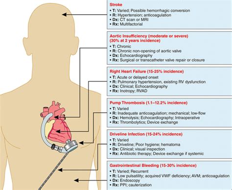 Left Ventricular Assist Devices Circulation