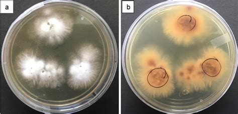 Aculture In Sabouraud Dextrose Agar B Culture In Sabouraud Dextrose