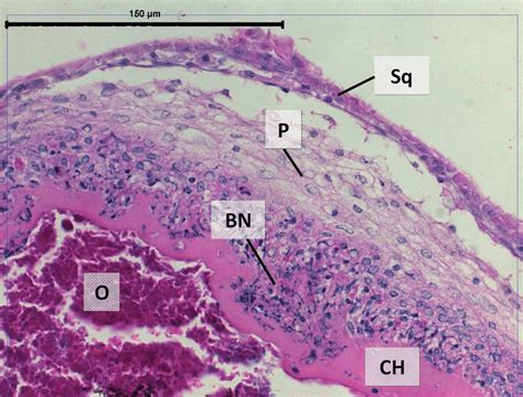 Describe The Structure Of Stratified Squamous Epithelium