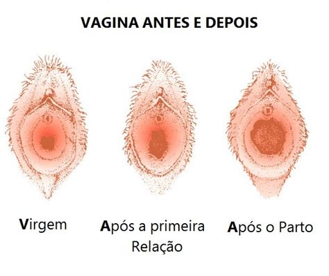 Creme Para Deixar Mulher Virgem Apertar Vagina Buceta Chana R 29 49