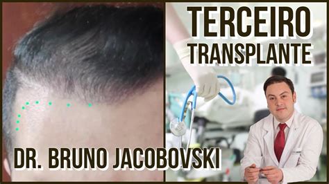 VOU FAZER MEU TERCEIRO TRANSPLANTE DR BRUNO JACOBOVSKI YouTube