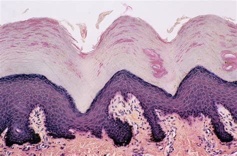 How Melanocytes Defend Your Skin Against Uv Rays