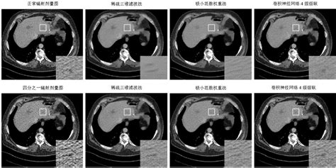 一种基于级联卷积神经网络的低剂量x射线图像去噪方法与流程