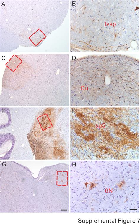 Widespread Spinal Cord Transduction By Intrathecal Injection Of Raav