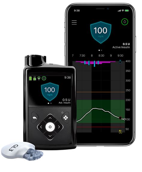 Dexcom vs Medtronic - Which is The Best CGM for You?