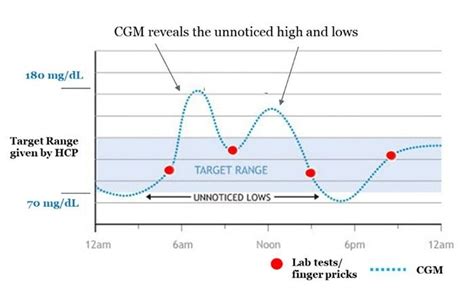 4 Top Tests For Diabetes Continuous Glucose Monitoring