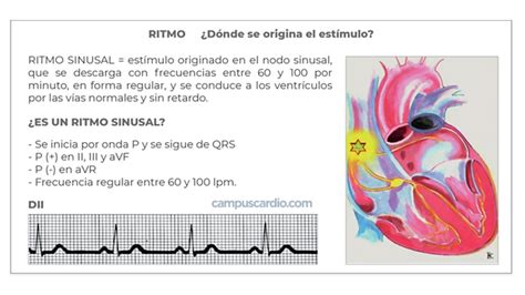 Ritmo Sinusal O Que é LIBRAIN