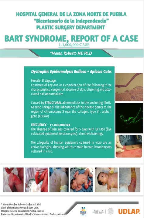 Bart Syndrome Report Of A Case Udlap Contexto