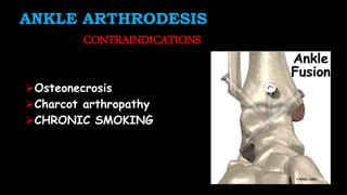 Arthrodesis indications & contraindications -PAWAN | PPT