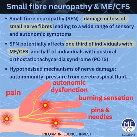 Small Fibre Neuropathy Sfn And Mecfs