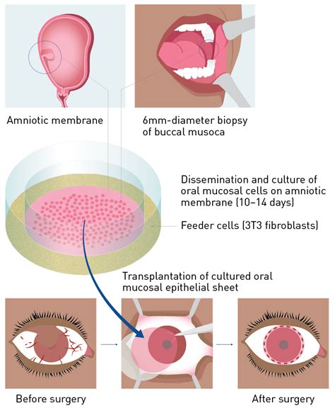 The Principles Of Regenerative Medicine Tissue Engineering 2