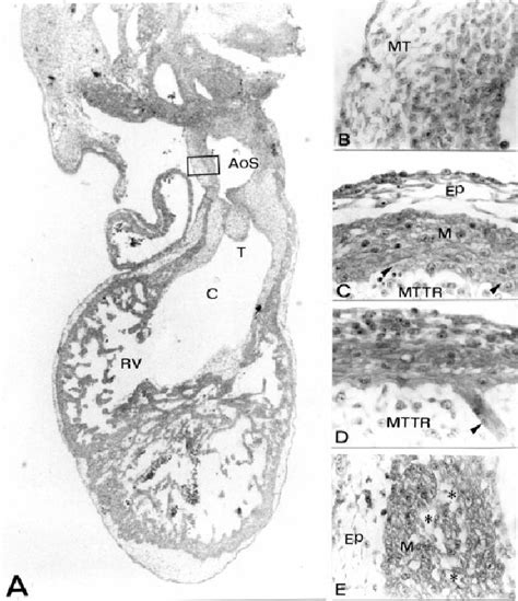 Photographs Of Histological Sections Of The Chick Embryo Heart At Stage