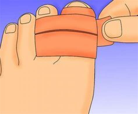 How To Heal A Broken Toe Steps With Pictures Wikihow