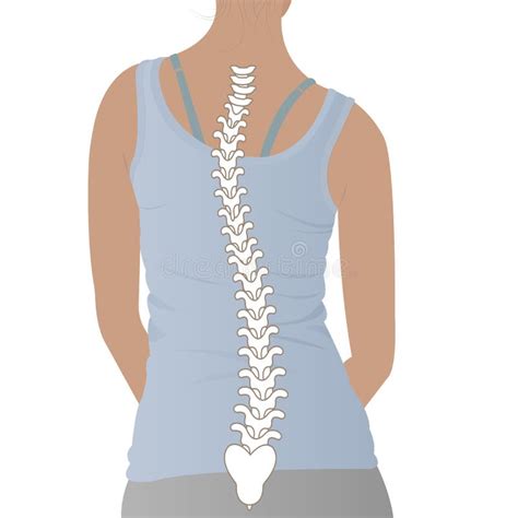 Anatomía De La Curvatura De La Columna Vertebral En Escoliosis