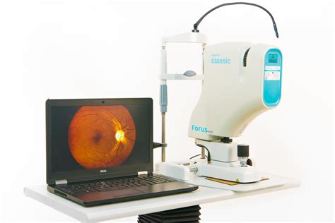 3nethra Classic Digital Non Mydriatic Fundus Camera Iapb Valued