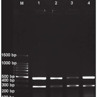 Association Between Clinicopathological Parameters And Expression Level